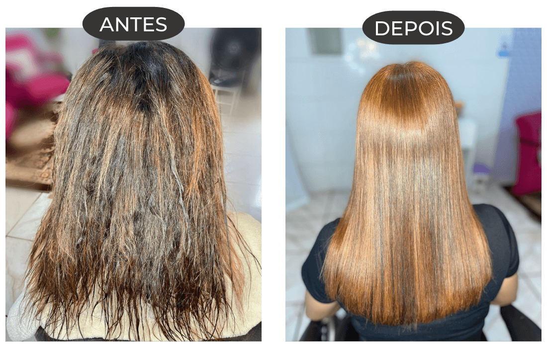 ANTES (3)