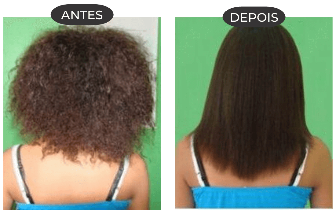 ANTES (4)